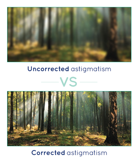 Uncorrected Astigmatism vs Corrected Astigmatism